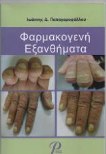 Φαρμακογενή Εξανθήματα