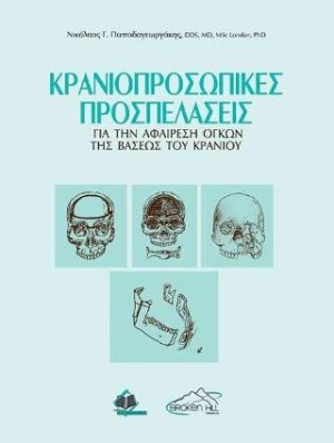 Κρανιοπροσωπικές Προσπελάσεις για την Αφαίρεση Όγκων της Βάσεως του Κρανίου