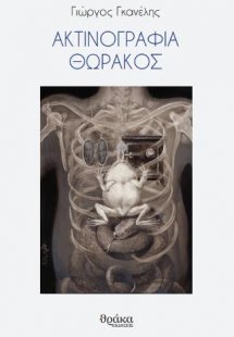 Ακτινογραφία θώρακος