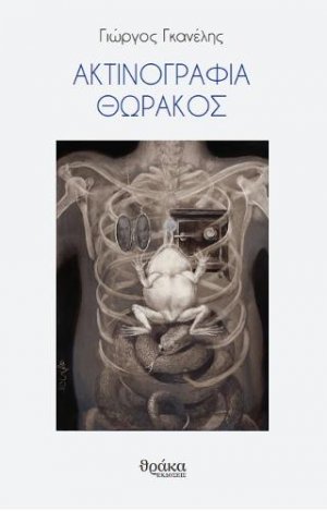 Ακτινογραφία θώρακος