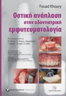 Οστική ανάπλαση στην οδοντιατρική εμφυτευματολογία