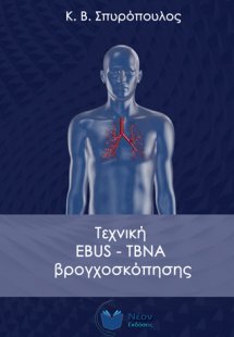 Τεχνική EBUS-TBNA βρογχοσκόπησης