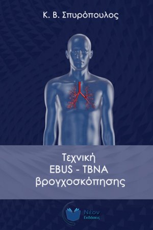 Τεχνική EBUS-TBNA βρογχοσκόπησης