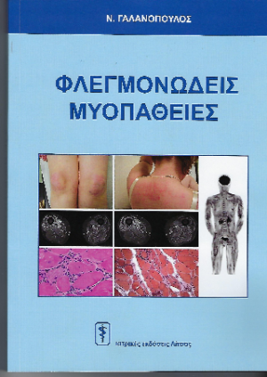 Φλεγμονώδεις Μυοπάθειες