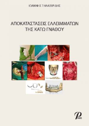 Αποκαταστάσεις ελλειμμάτων της κάτω γνάθου
