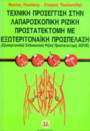 Τεχνική προσέγγιση στη λαμπαροσκοπική ριζική προστατεκτομή με εξωπεριτοναϊκή προσπέλαση