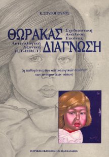 Θώρακας – διάγνωση-Σχεδιαστική ανάλυση εικόνας, ακτινολ...
