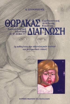 Θώρακας – διάγνωση-Σχεδιαστική ανάλυση εικόνας, ακτινολογική αξονική