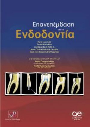Επανεπέμβαση στην Ενδοδοντία