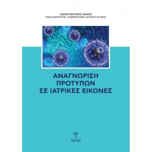 Αναγνώριση προτύπων σε ιατρικές εικόνες