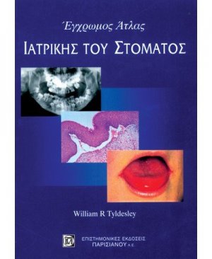 Έγχρωμος άτλας ιατρικής του στόματος