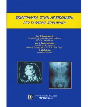 Σκιαγραφικά στην απεικόνιση