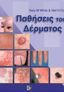 Παθήσεις του δέρματος