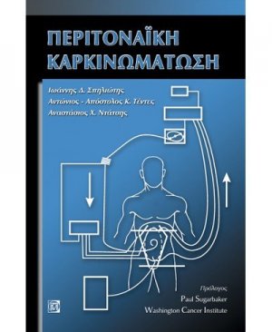Περιτοναϊκή καρκινομάτωση