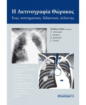 Η ακτινογραφία θώρακος