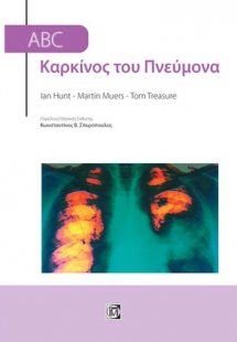 ABC Καρκίνος του πνεύμονα