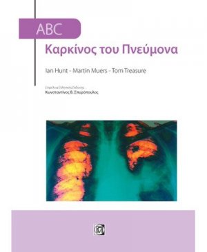 ABC Καρκίνος του πνεύμονα