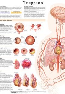Ανατομικός Χάρτης: Υπέρταση