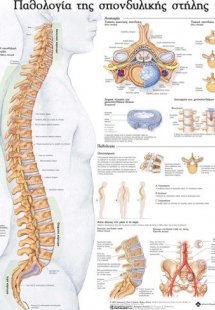 Ανατομικός Χάρτης: Παθολογία της σπονδυλικής στήλης