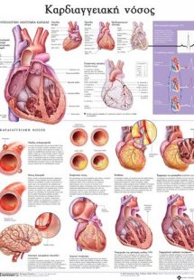 Ανατομικός χάρτης: Καρδιαγγειακή νόσος