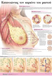 Ανατομικός χάρτης: Κατανοώντας τον καρκίνο του μαστού