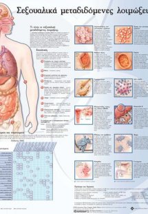 Ανατομικός Χάρτης: Σεξουαλικά Μεταδιδόμενες Λοιμώξεις