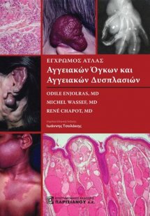 Έγχρωμος άτλας αγγειακών όγκων και αγγειακών δυσπλασιών