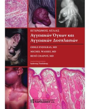 Έγχρωμος άτλας αγγειακών όγκων και αγγειακών δυσπλασιών