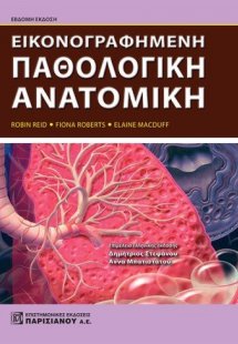 Εικονογραφημένη παθολογική ανατομική