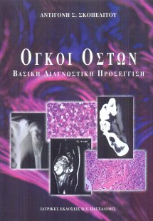 Όγκοι οστών