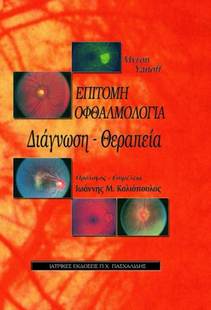 Επίτομη Οφθαλμολογία Διάγνωση – Θεραπεία