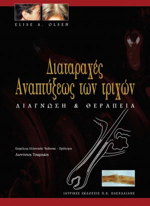 Διαταραχές αναπτύξεως των τριχών-Διάγνωση και θεραπεία