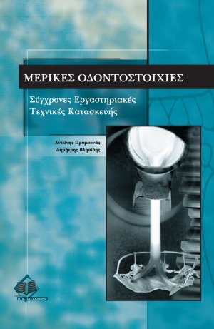 Μερικές οδοντοστοιχίες - Σύγχρονες εργαστηριακές τεχνικές καταστευής