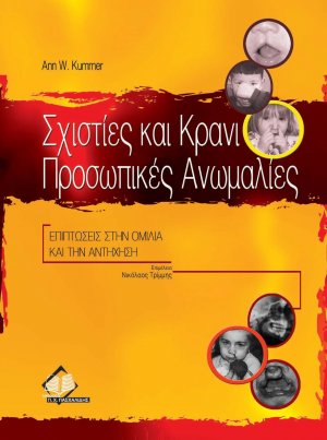 Σχιστίες και κρανιοπροσωπικές ανωμαλίες