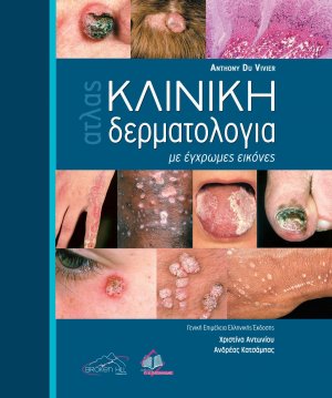 Κλινική Δερματολογία με Έγχρωμες Εικόνες