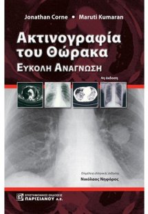 Ακτινογραφία του θώρακα