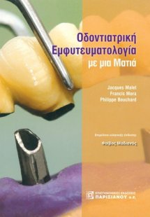 Οδοντιατρική εμφυτευματολογία με μια ματιά