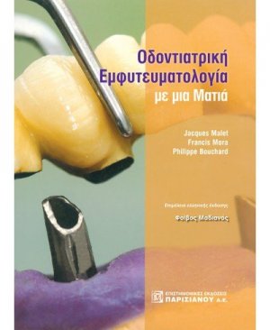Οδοντιατρική εμφυτευματολογία με μια ματιά