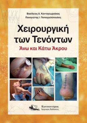 Χειρουργική των Τενόντων