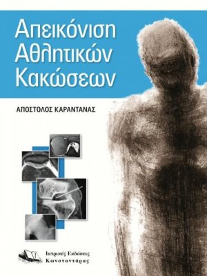 Απεικόνιση αθλητικών κακώσεων