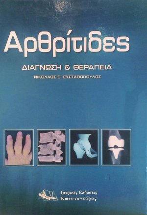 Αρθρίτιδες