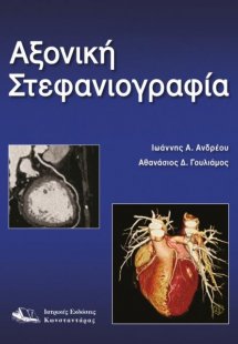 Αξονική στεφανιογραφία