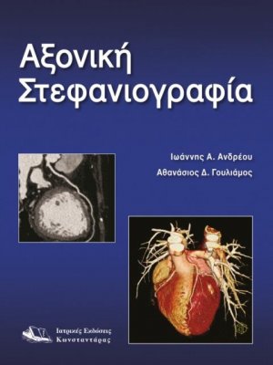 Αξονική στεφανιογραφία