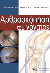 Αρθροσκόπηση του γόνατος