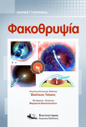 Φακοθρυψία
