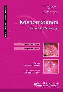 Κολποσκόπηση
