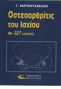 Οστεοαρθρίτις του ισχίου
