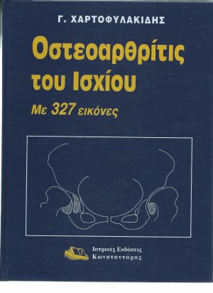 Οστεοαρθρίτις του ισχίου