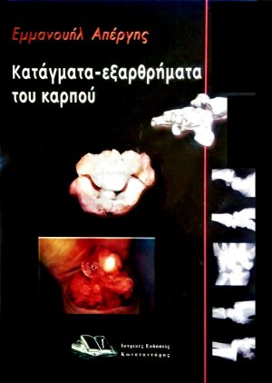 Κατάγματα - εξαρθρήματα του καρπού
