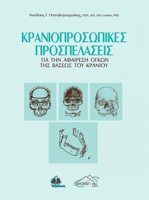 Κρανιοπροσωπικές Προσπελάσεις για την Αφαίρεση Όγκων της Βάσεως του Κρανίου